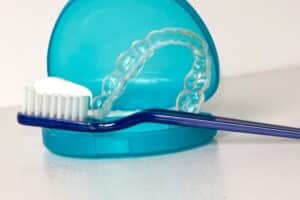 All about retainers 9 Retainers