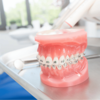 Is orthodontist training different than a dentist? 11 Orthodontist